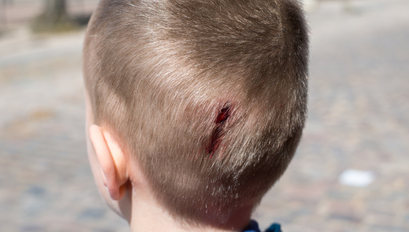 Autisme: que faire lorsqu'il s'automutile ?